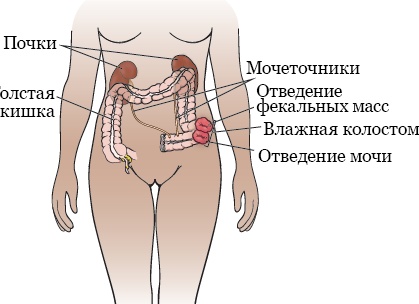 5 вещей, из-за которых женщина уходит