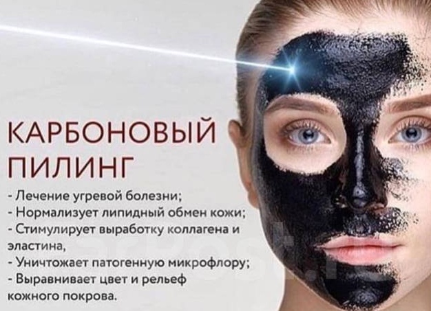 Карбоновый пилинг